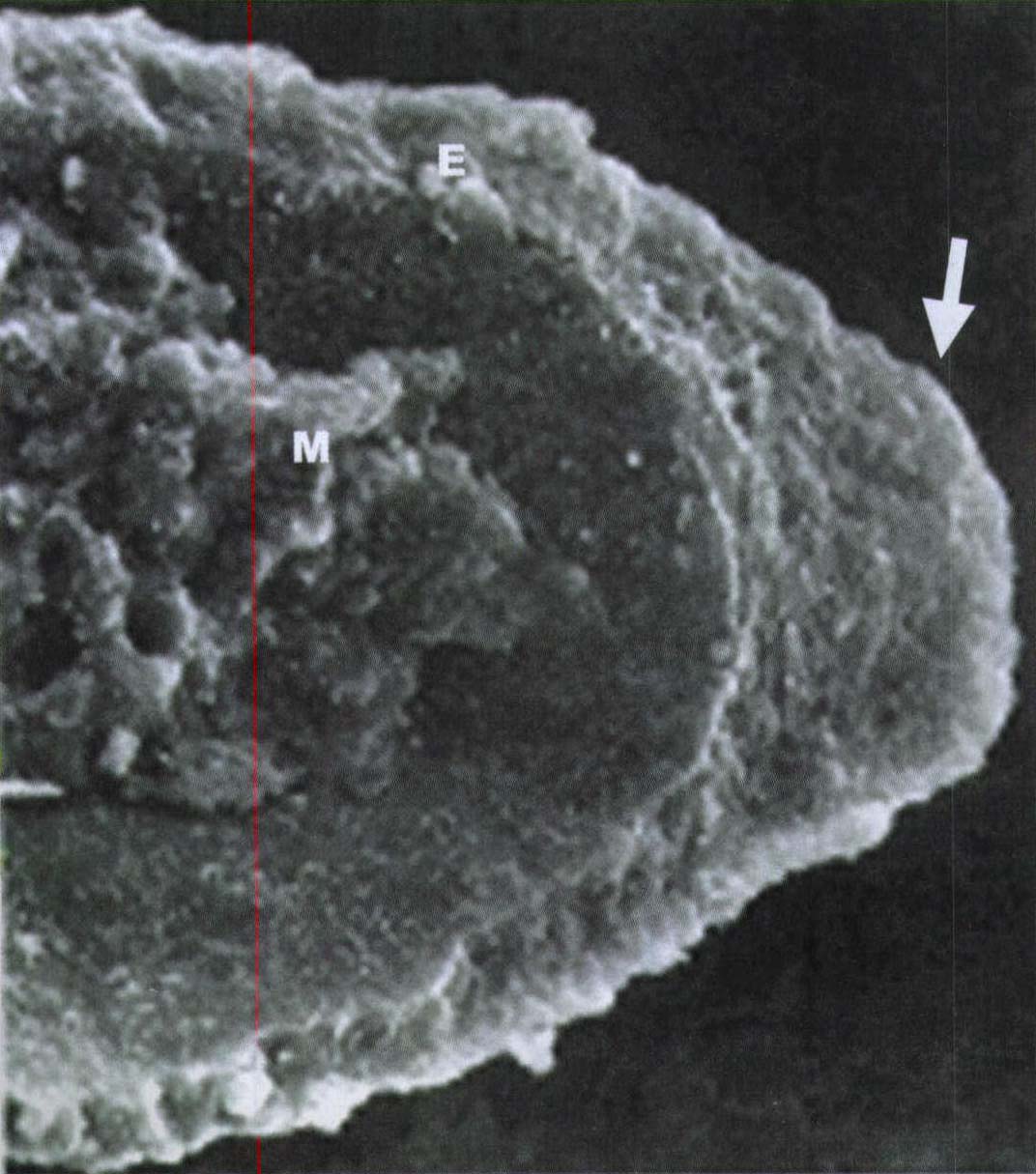 图1-4 外胚层顶嵴的结构